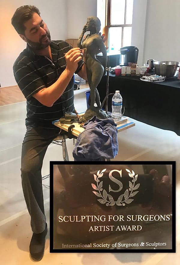 Our Surgical Team the sculptor